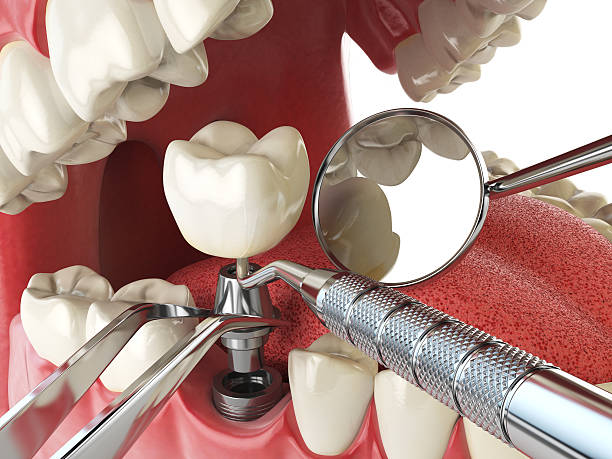 Best Walk-In Emergency Dentist in Mountain View Ranches, AZ